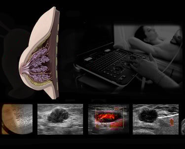 Breast ultrasound images.