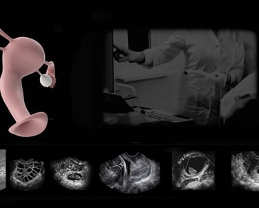 Transvaginal ultrasound training session.