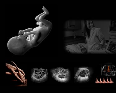 Obstetric ultrasound scanning session.