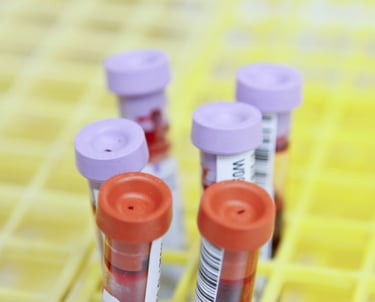 Exames de sangue