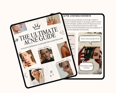 Digital guide titled 'The Ultimate Acne Guide: A holistic approach to healing and accepting acne'.
