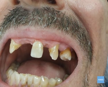 Paciente en clínica dental de Badajoz