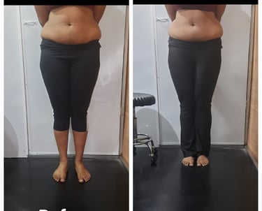 Slimmer waistline before and after fat cavitation body treatment