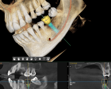 mouans-sartoux dentiste