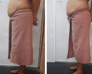 Slimmer waistline before and after fat cavitation body treatment