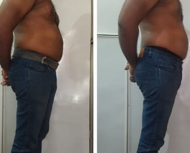 Slimmer waistline before and after fat cavitation body treatment