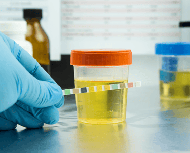 urine drug test | drug screening | 5 panel | 10 panel 