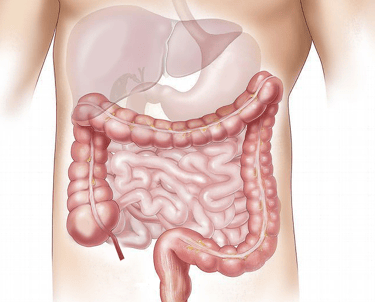 a diagram of an intestine