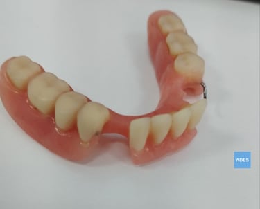 prótesis dental