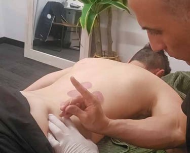 Action shot showing male massage therapist inserting a dry needle into someone
