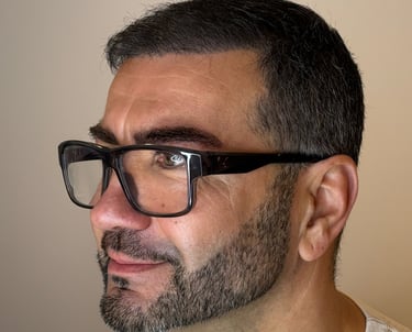 Dermopigmentation capillaire SMP sedan et charlevilles 08 pour calvitie et alopécie 