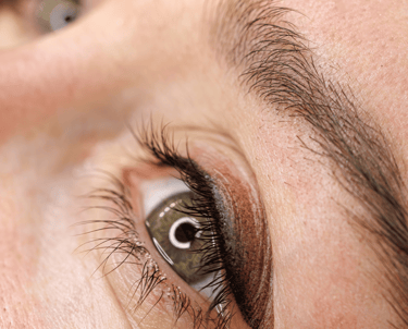 Close-up of client’s eyes with shaded or smudged permanent eyeliner