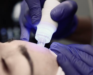 Zabieg oczyszczania wodorowego twarzy w OG Cosmetology