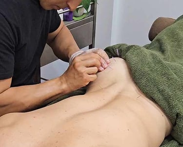 Wollongong Therapist putting needles into a buttock as part of dry needling massage
