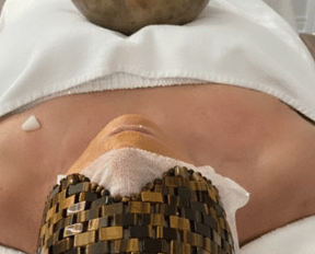 Facial ayurveda purifiant à Boucherville : rituel spa et hydratation profonde chez Insia Beauté.