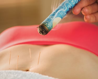 combinação terapeutica de moxabustao e agulhas de acupuntura