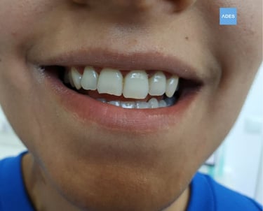 clinica dental ades ortodoncia infantil