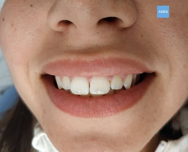 Ortodoncia infantil clinica dental ades