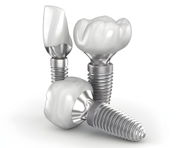 Single Tooth Dental Implant Cost and Procedure in Hyderabad