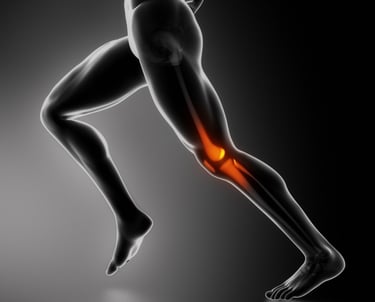 Ilustración anatómica de un corredor con dolor e inflamación resaltados en la articulación