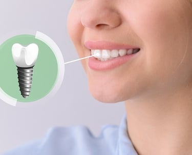 dental implant specialist baner