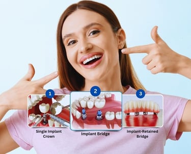 dental implant specialist in baner