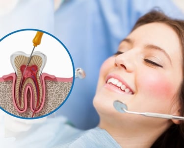 root canal treatment in baner