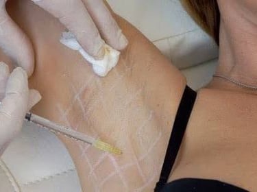a woman in a brailler and gloves is getting her arm wrapped in a