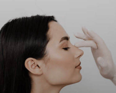 Rinoplasti (burun estetiği) sonrası yüz ile uyumlu burun görünümü