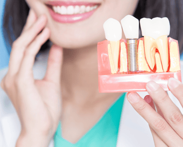 Affordable Dental Implants in Navi Mumbai | Ekdantam Dental Clinic kopar khairane