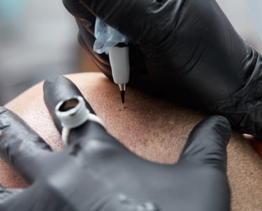 Scalp Micropigmentation in Toronto_ATRUBARBER Scalp Micropigmentation Studio
