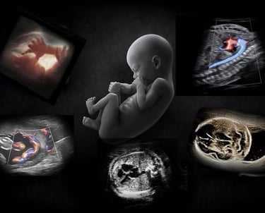 Image of a fetus surrounded by ultrasound images of obstetric ultrasound.