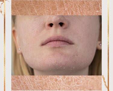 Dry Skin Care ray and rio's speciality clinic