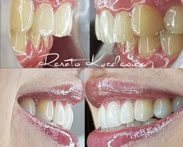 Antes e depois