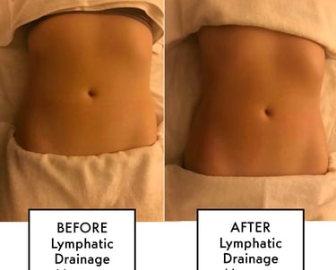 lymphatic massage
