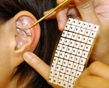 sevrage tabagique nîmes par l'auriculothérapie