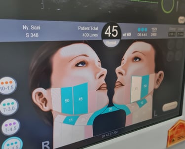 Targeted Ultrasound Ultherapy