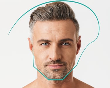 Armonización facial masculina para definir el mentón y resaltar los rasgos del rostro