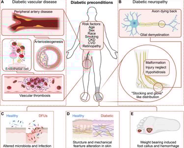 contributing factors in diabetes leading to diabetic foot ulcers