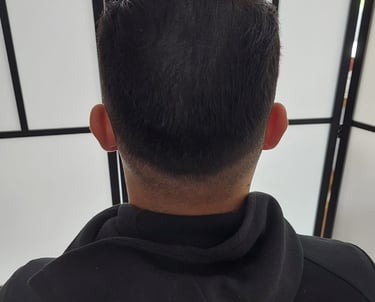 homme qui a fait une micropigmentation capillaire pour densifier sa chevelure