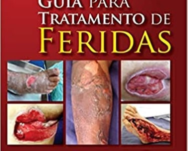 LIVRO TRATAMENTO DE FERIDAS