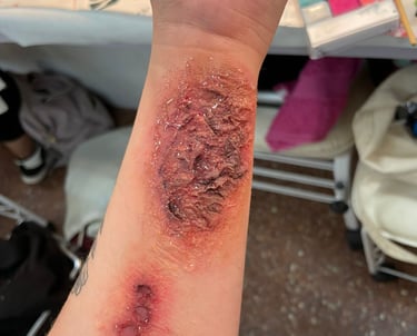 foto herida halloween