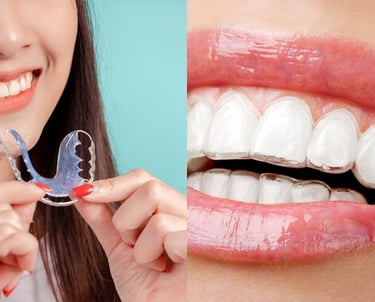 alineadores invisibles y metalicos