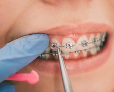 a woman with braces and braces in her teeth