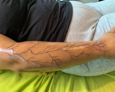 Tatouage graphique avant-bras motif veines organiques réalisé par A2C Tattoo à Challes-les-Eaux