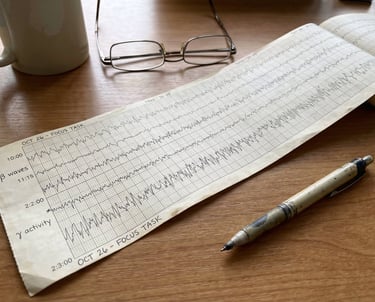 An EEG strip showing beta and gamma waves of the brain