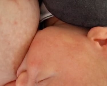 baby breastfeeding after tongue tie division with private midwife anika riesen