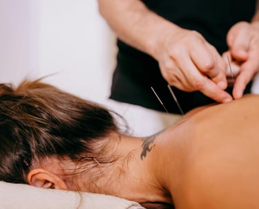 Woman getting dry needles placed to treat muscle pain and tension