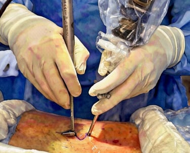 Figura artistica mostrando a cirurgia biportal UBE da coluna em Fortaleza