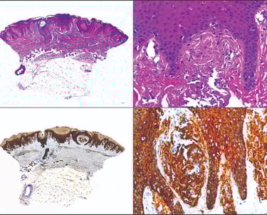 inmunoistoquimia